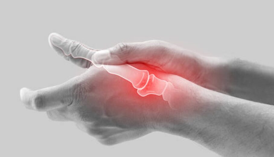 ROMATOİD ARTRİT HASTALARINA 8 ÖNEMLİ KIŞ ÖNERİSİ